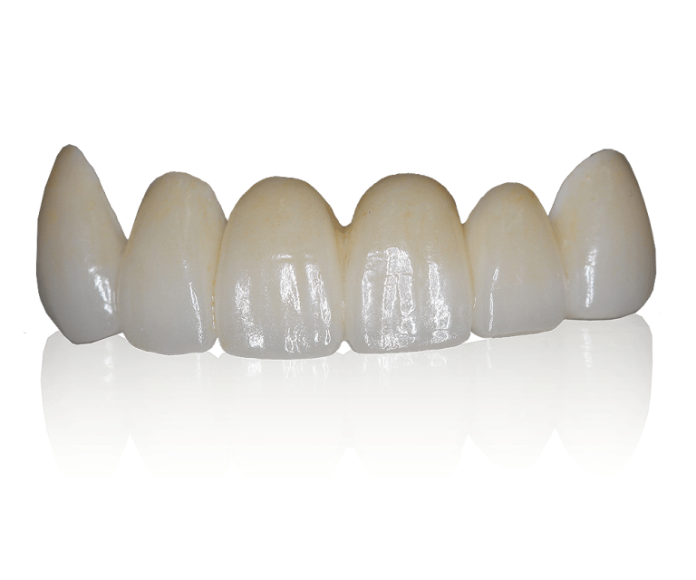 Full Zirconia Crown – OB Dental Labs