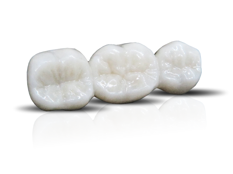 Full Zirconia Crown – OB Dental Labs